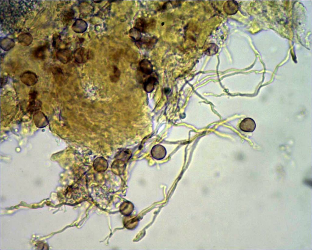 Non nivicolous Diderma